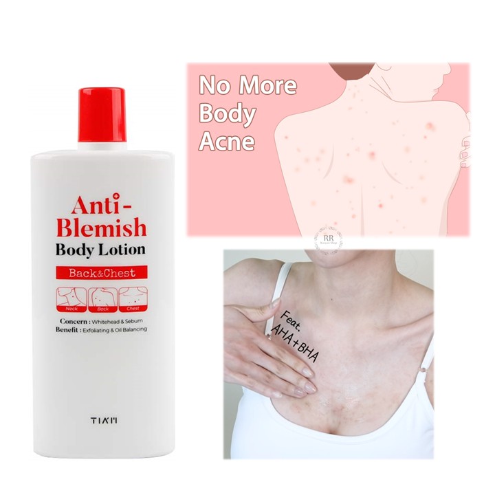 anti blemish body lotion