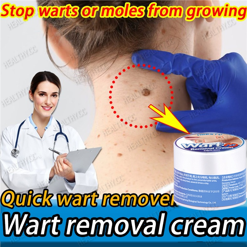 Warts Remover Original Cream Kasoy Oil Cream Kulugo Mole Skin Tag Wart Remover Wart Removal
