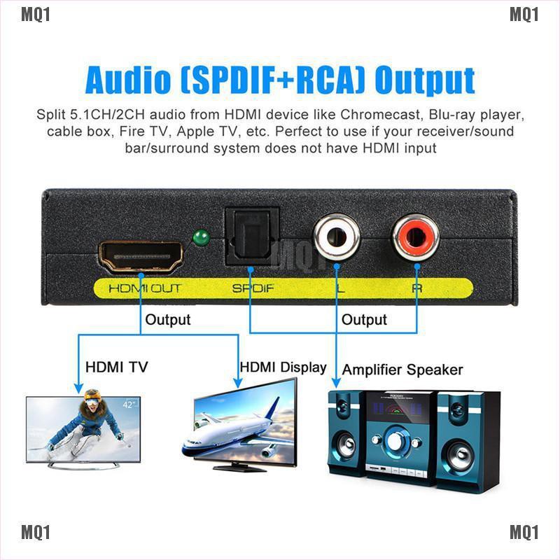 rca hdmi surround sound system