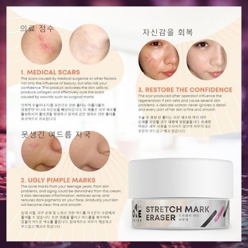 one korea stretch mark eraser