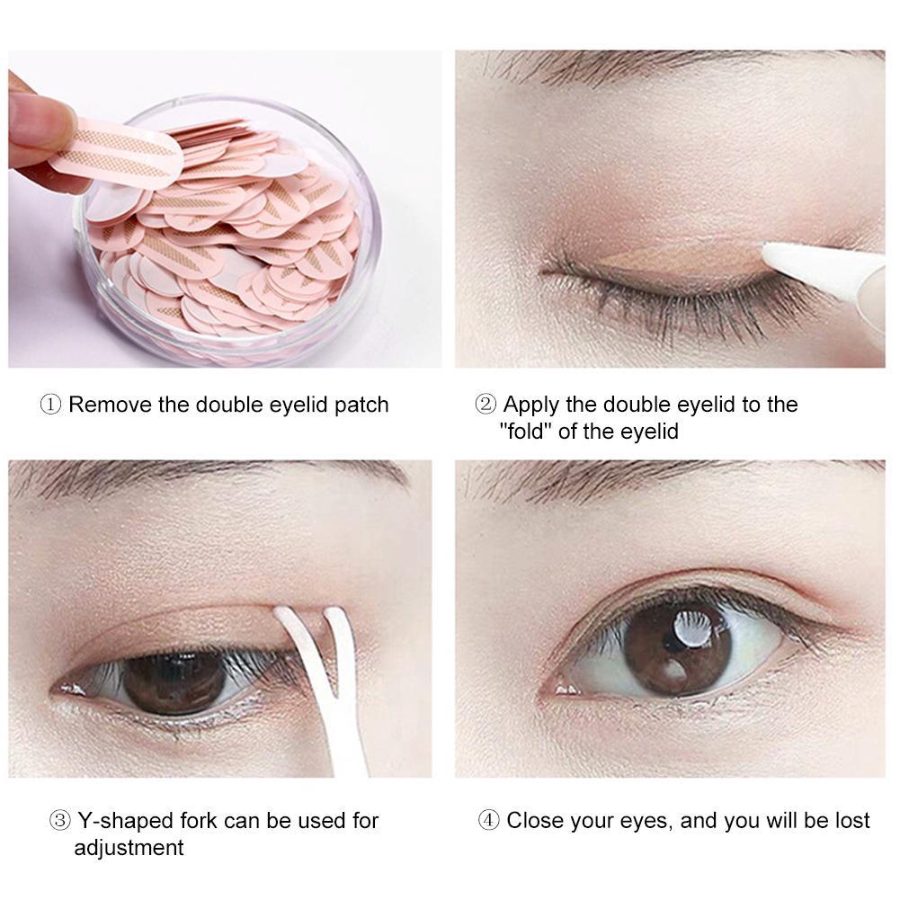 remove double eyelid