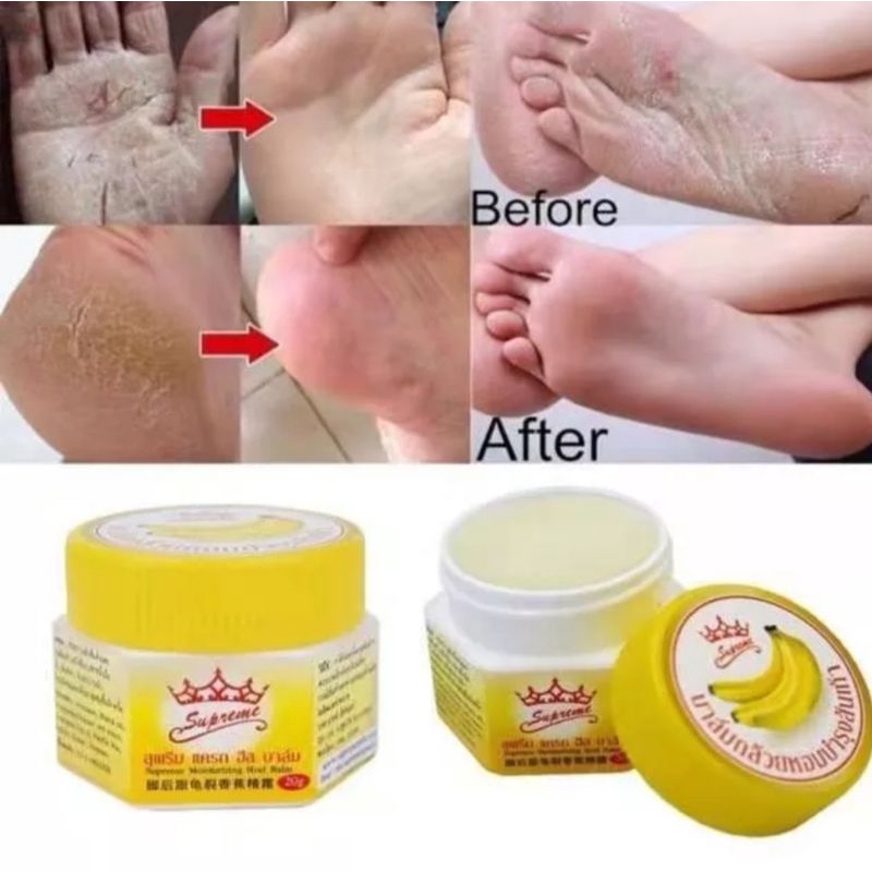 Authentic Thai Supreme Banana Moisturizing Heel Balm | Shopee Philippines