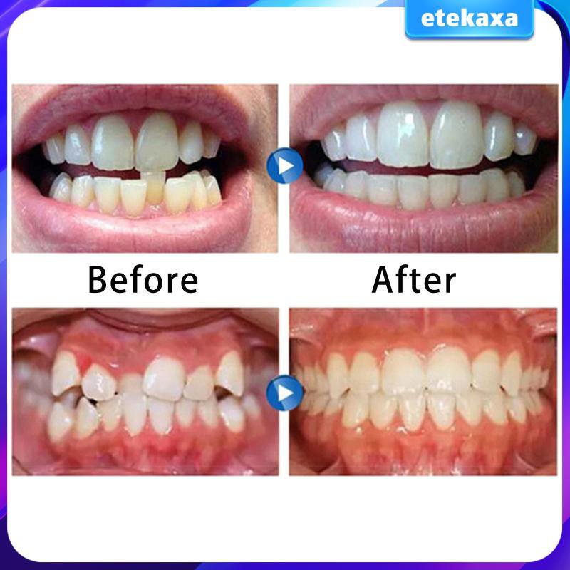 high quality3In1 Teeth Retainer Tooth Aligners Trays Straighten