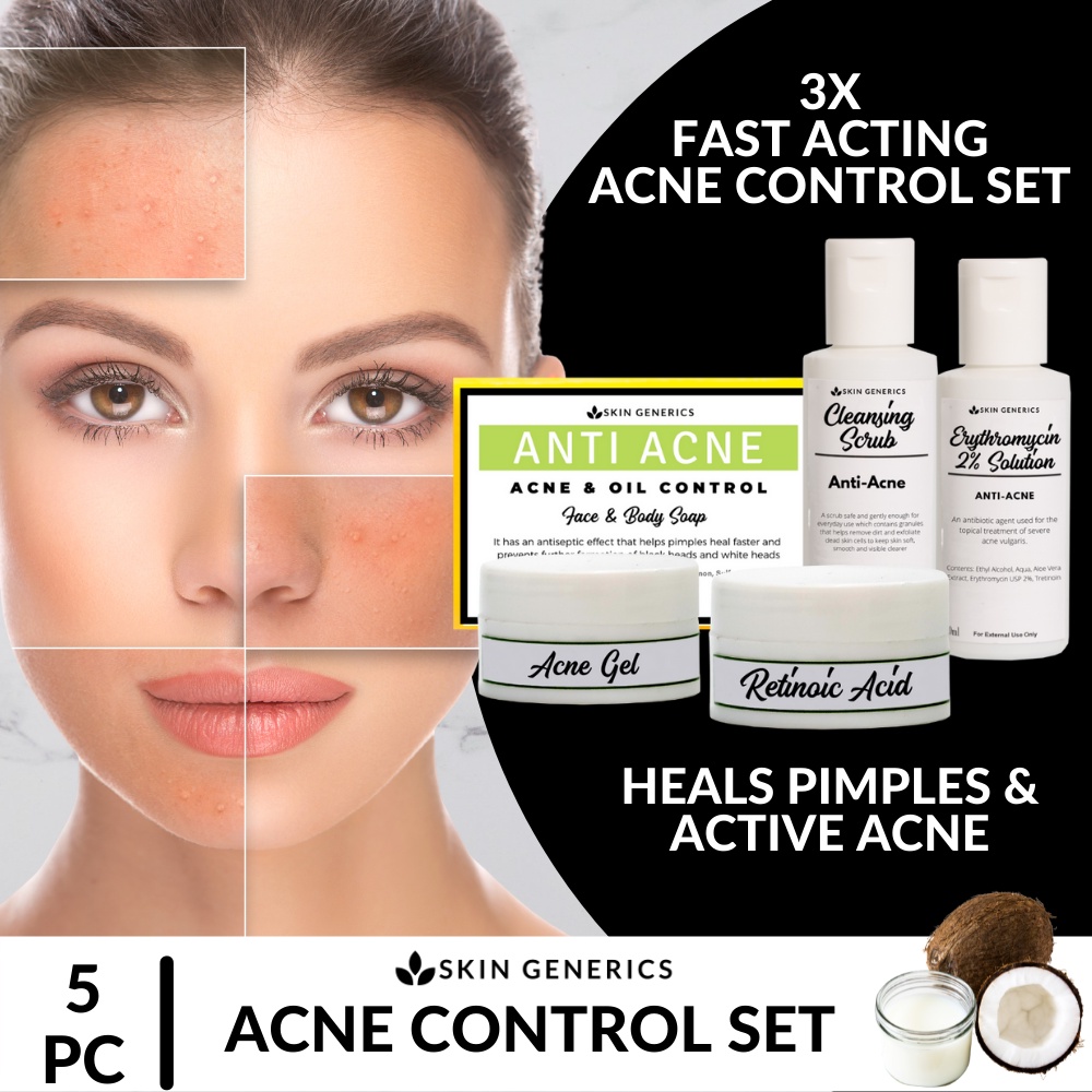 [ACNE TREATMENT CONTROL SET] SkinGenerics Acne Control Set - 5PC Set ...