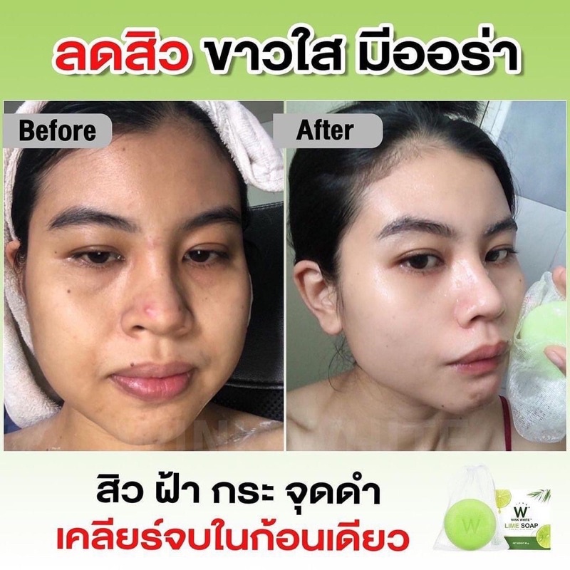 !!️ ่Wink White Lime Soap Lemon Win Gold Free Wink Accelerate Skin (1 Piece Size 80 G.)