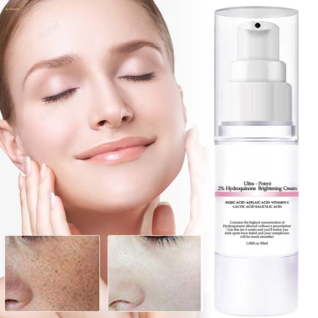 Hydroquinone Skin Whitening Cream 30g Anti Blackhead Facial Moisturizer ...