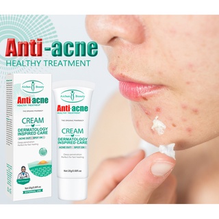 Acne Treatment Acne Scar Remover Facial Cream Skin Care Anti Acne Cream Pores Cream