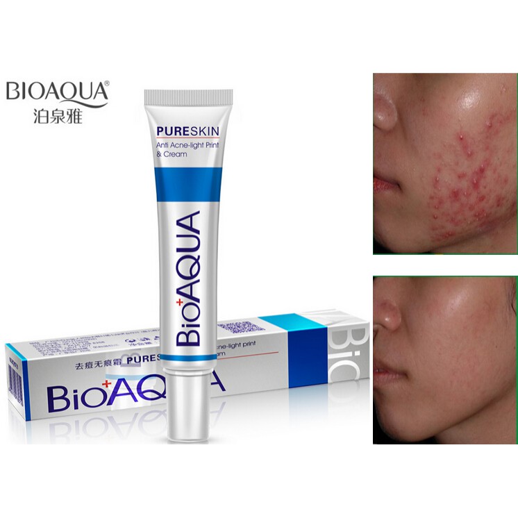 acne rejuvenation cream