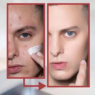 Seebee 50g Men's BB Cream Facial Cream Fades Acne Acne Concealer Brightening Lotion #5