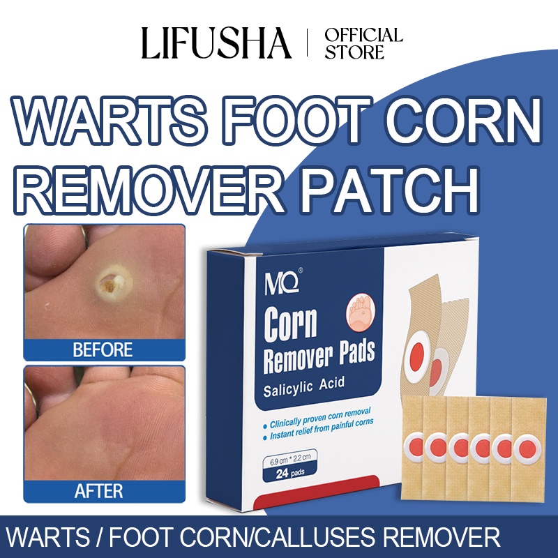 LIFUSHA 48PCS Foot Corns Remover Patch Warts Remover Pad Callus Removal
