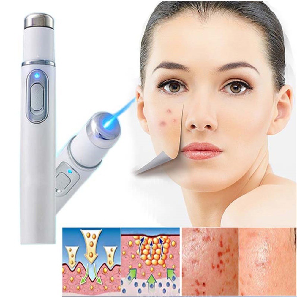 Acne Laser Pen Portable Wrinkle Removal Machine Durable Soft Scar