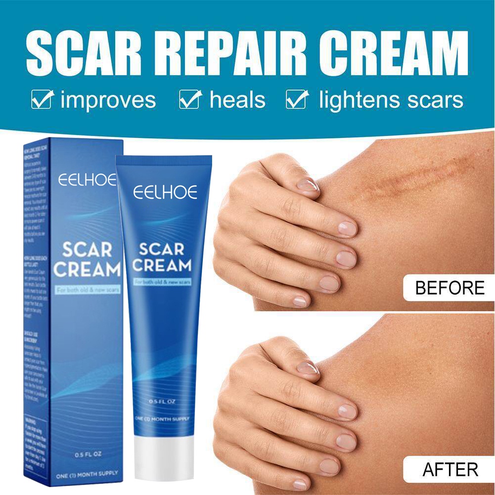Scar Remover Cream Scar Removal Cream Baby Scar Remover Dilute And