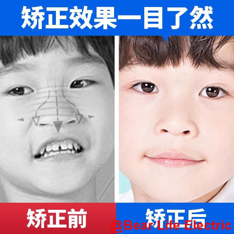 Hot mouth breathing stickers correcting nozzle breathing, stickers