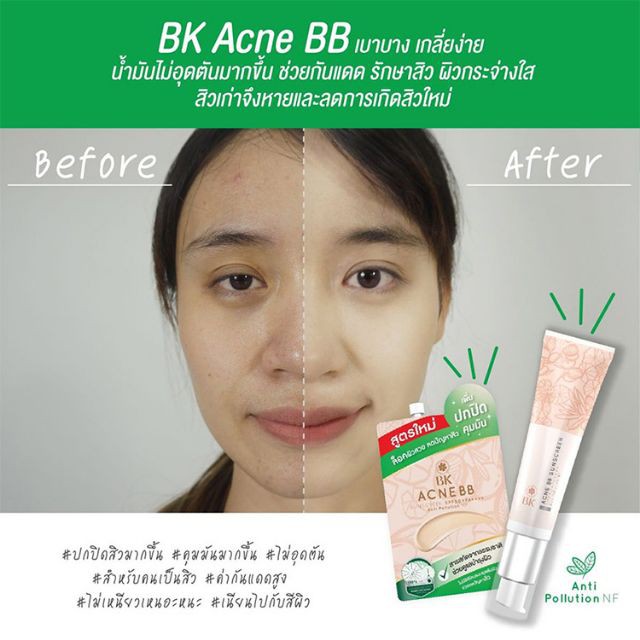bk acne sunscreen