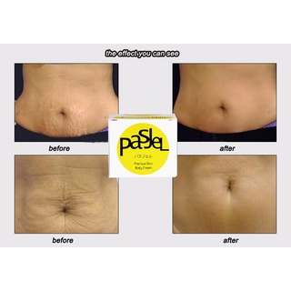 original pasjel stretch mark cream