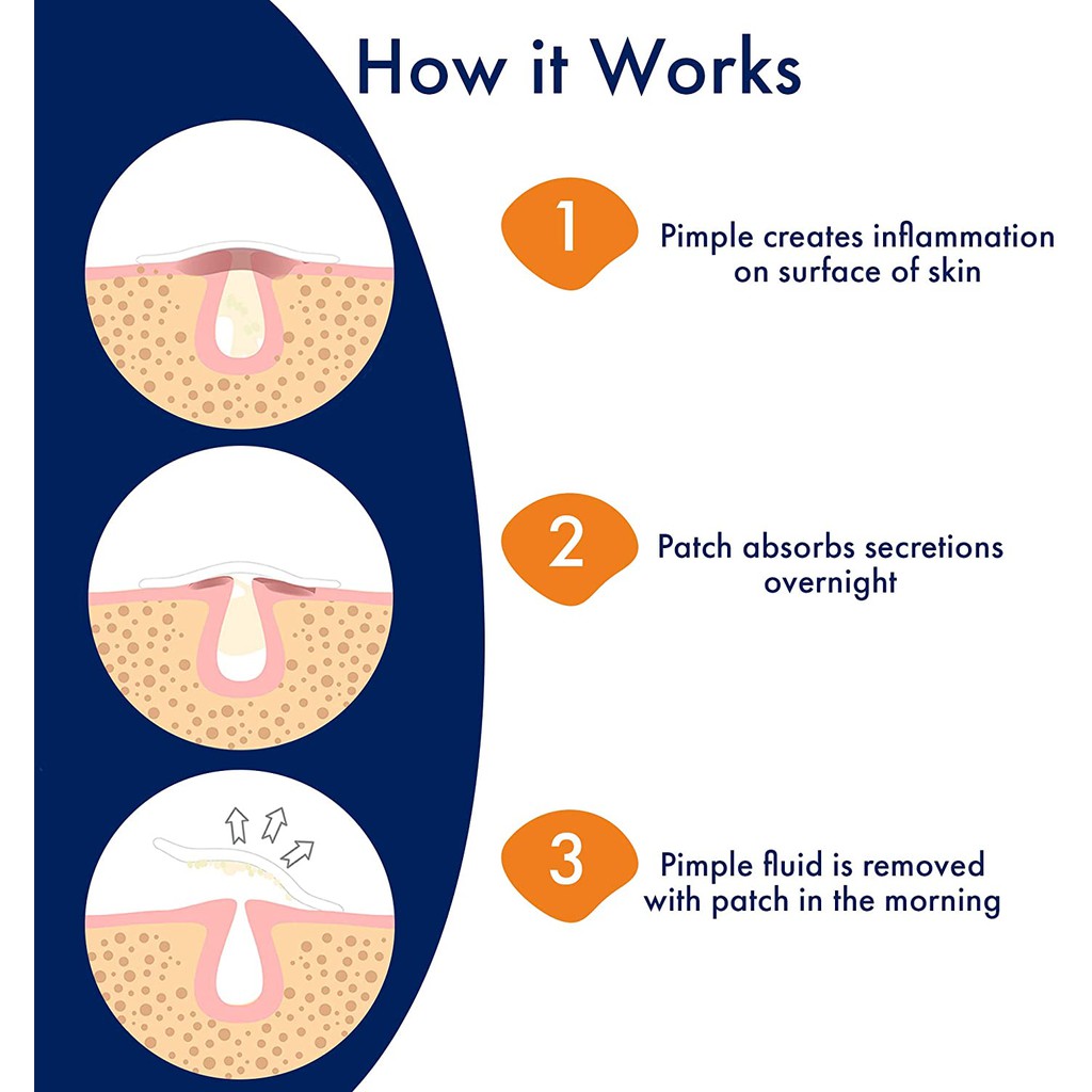 panoxyl pimple patches