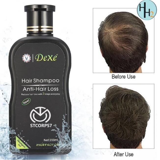 AUTHENTIC DEXE Organic Hair Grower 