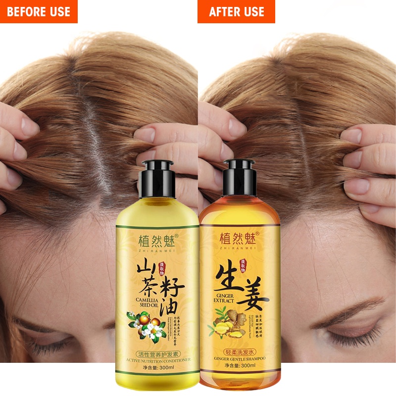 ZRM Ginger Hair Care Shampoo Hair Loss Treatment 300ml Anti Hair Loss