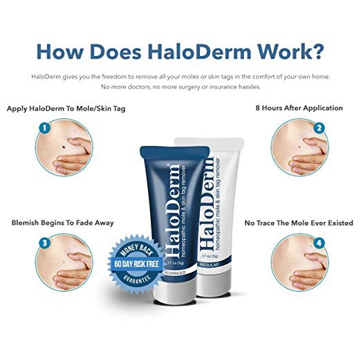 haloderm skin tag remover