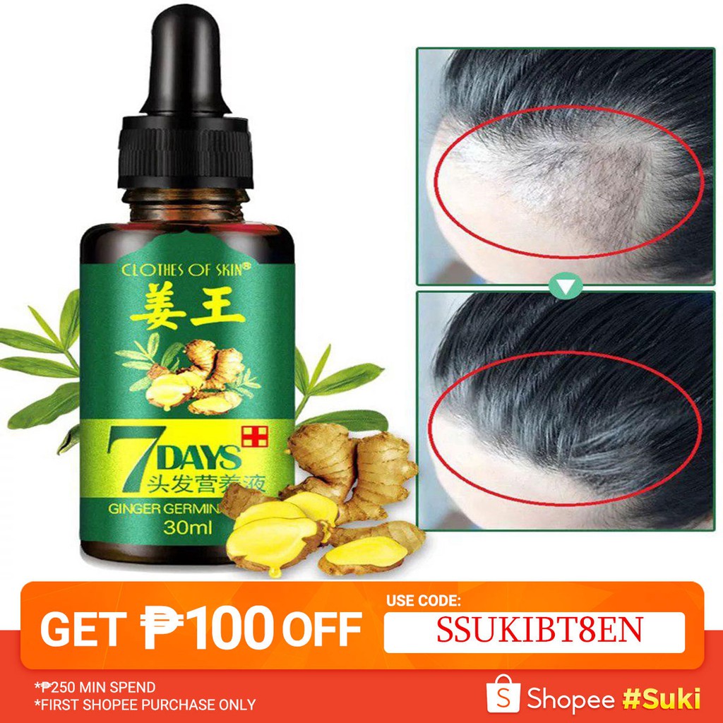 Hair Growth Oil Natural Ginger Germinal Essential Oil Treatment