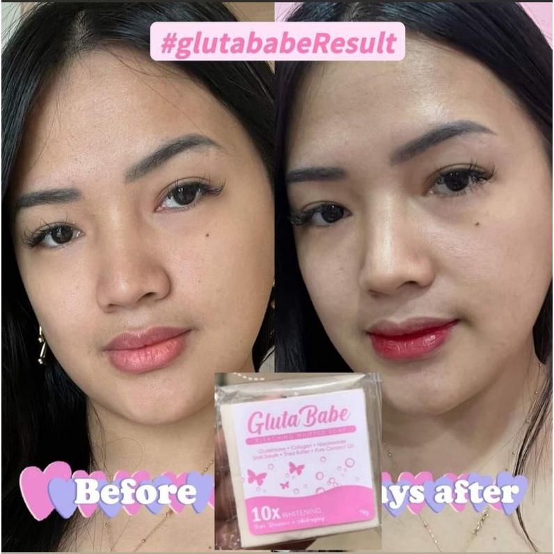 FDA approved Gluta babe whipped bleaching soap & Keratin plus(Intense brazillian hair treatment)