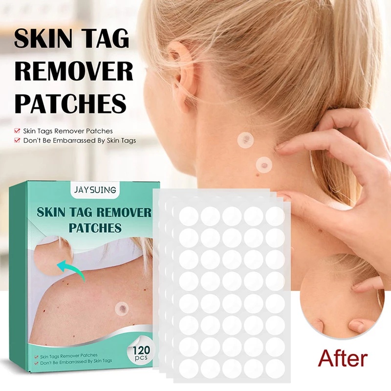 Skin Tag Remover Patches Wart Stickers 120pcs Skin Cleansing Care Skin