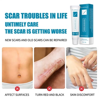West&Month Acne Treatment Dark Spot Remover Repair Strech Marks 20g Acne Scar Pimples Marks Acne Sc #2