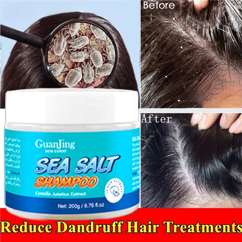 200g Sea Salt Shampoo Psoriasis Treatment Shampoo Anti Dandruff Scalp