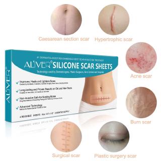 silicone gel sheets for acne scars