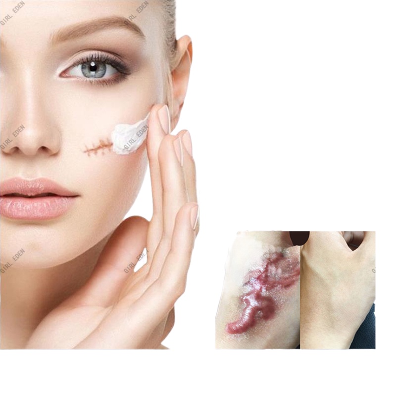 PEIMEI Scar Removal Gel Cream Acne Treatment Stretch Marks Removal Ointment Keloid Acne Scar