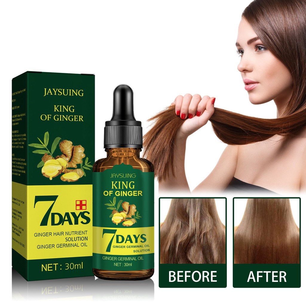 Hair Loss Treatment Ginger Hair Growth Oil For Thicker Hair | Shopee  Philippines