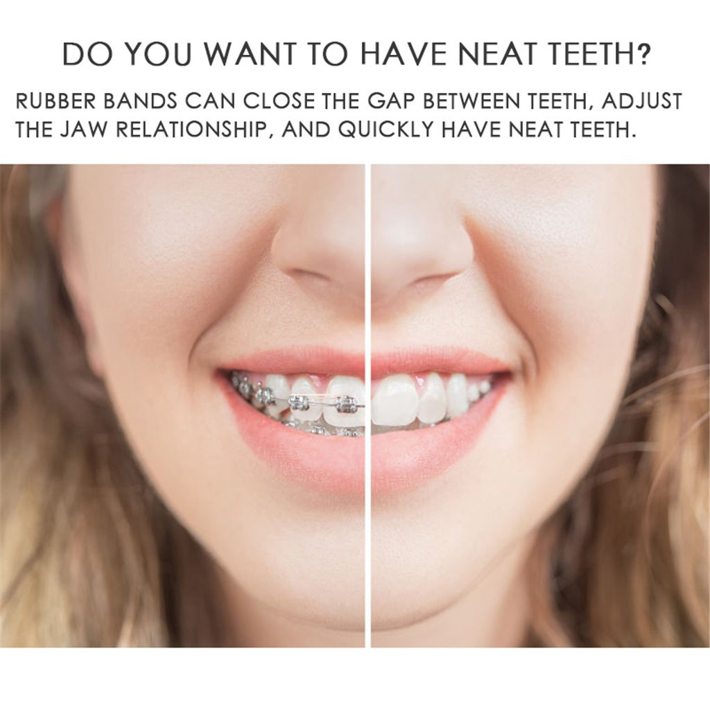 teeth rubber
