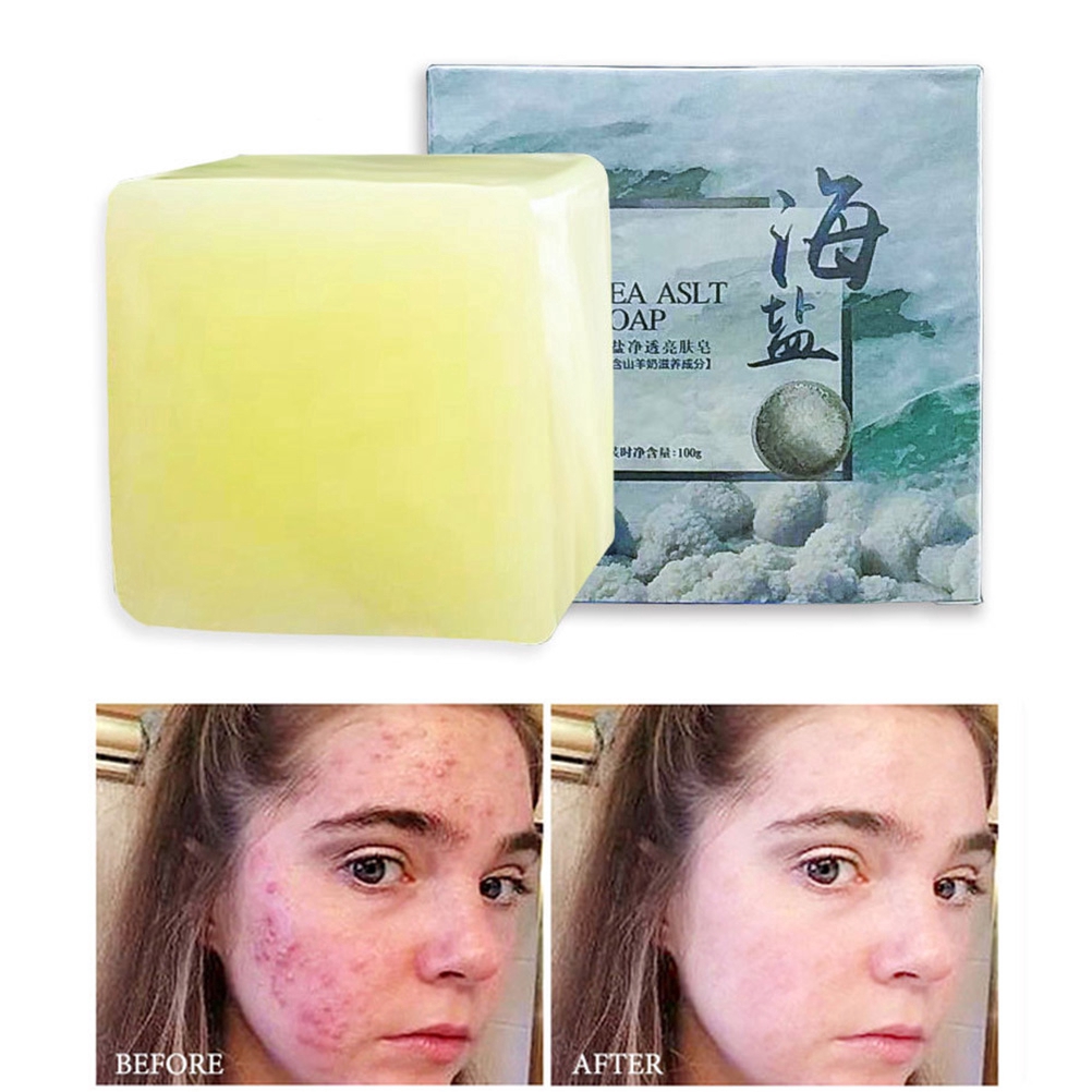 pores soap