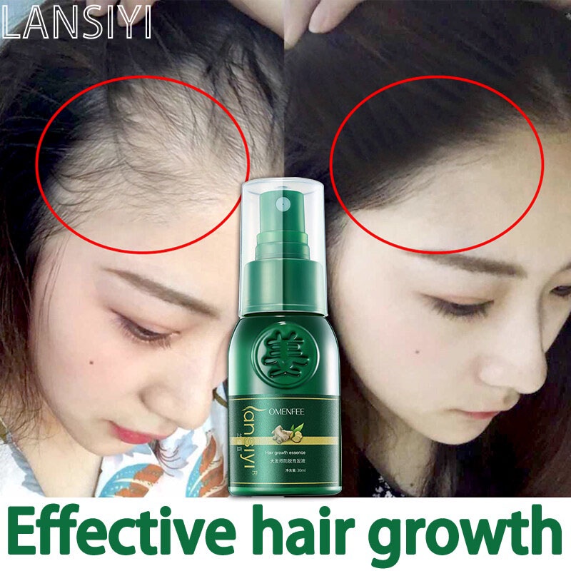 LANSIYI Hair serum ginger king hair serum oil hair growth essential Antihair loss strong hair