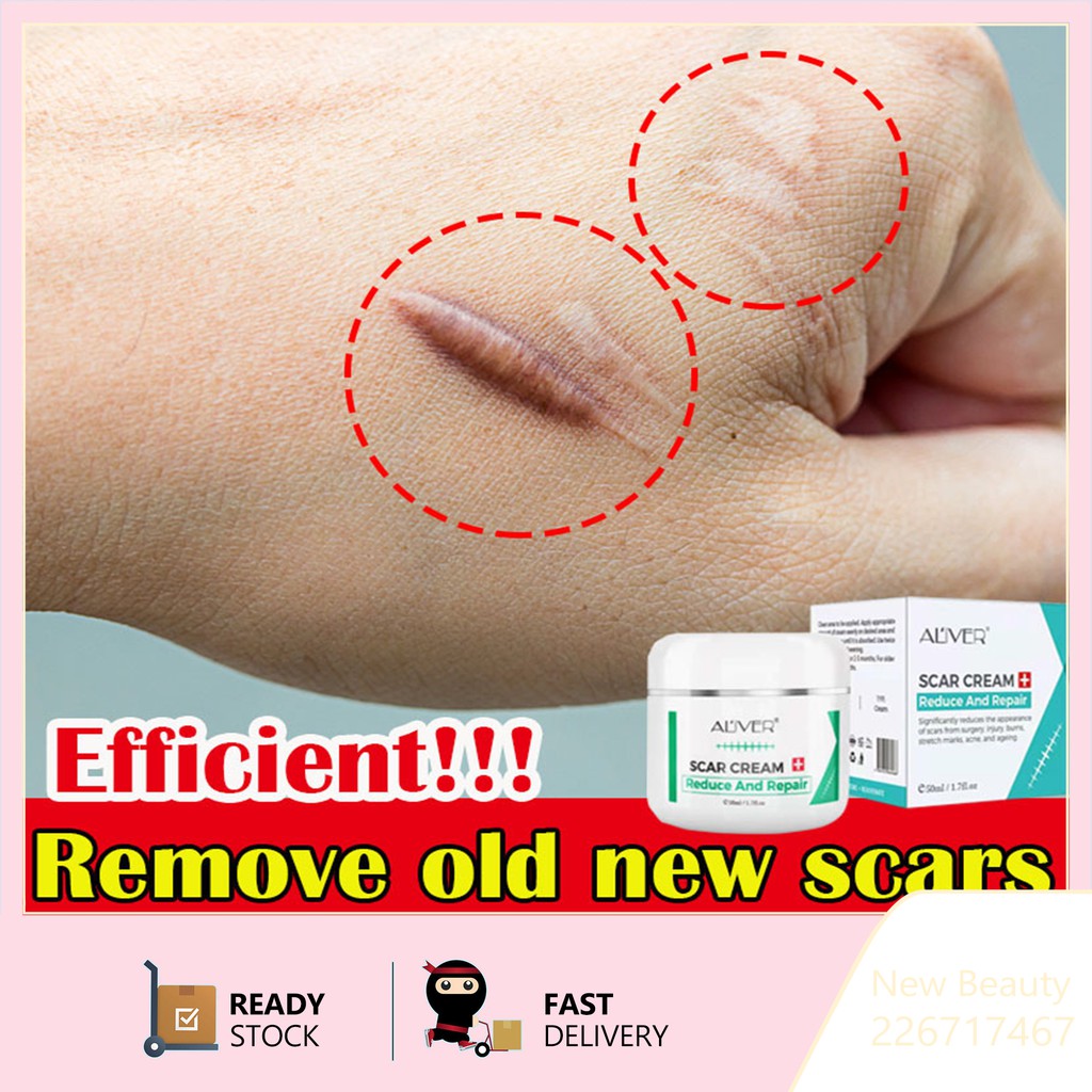 Aliver Scar Cream 50ml Effectively Repair Surgical Scars Burns Pregnancy Marks And Acne Marks 9880