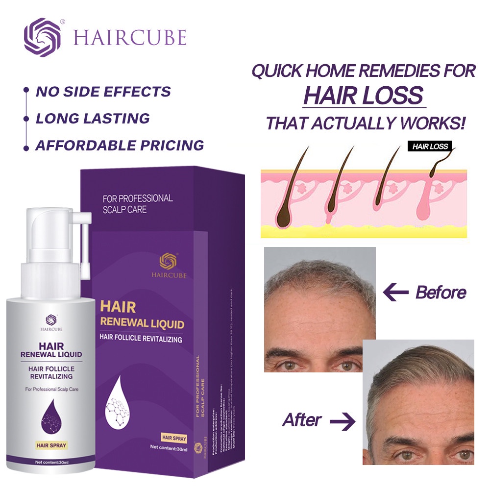 HAIRCUBE Hair Growth Spray for Fast Hair Growth Treatment Oil Anti Hair Loss  Serum Hair Tonic Hair | Shopee Philippines
