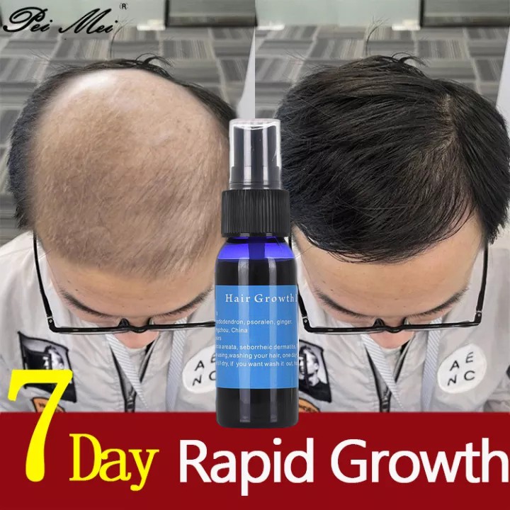 Hair Grower for Men Women Hair Treatment Hair Growth Spray Essence Hair