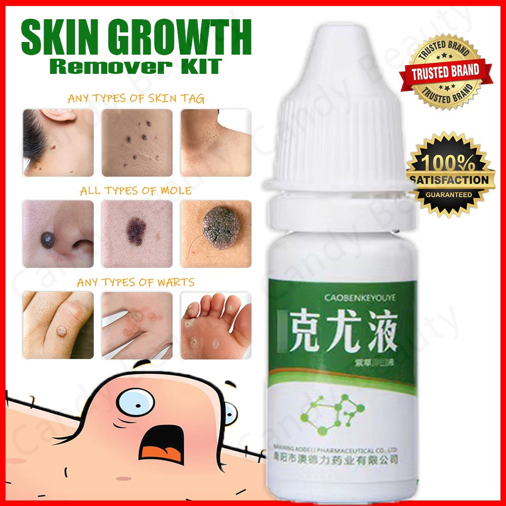10ml Effective Oil Warts Remover Warts removal Milia Skin tags