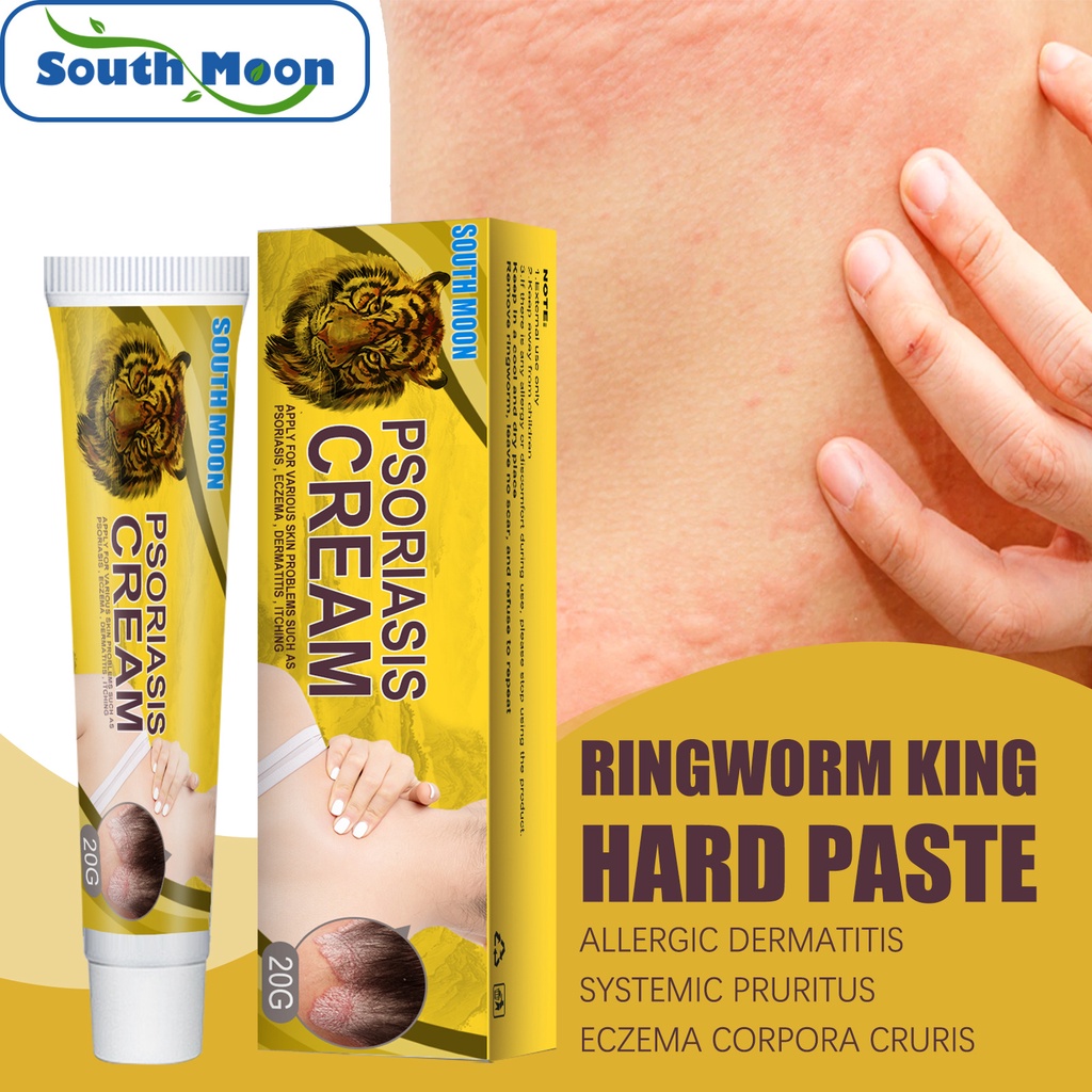 South Moon Ringworm ointment Skin anti moss cream flower spot moss