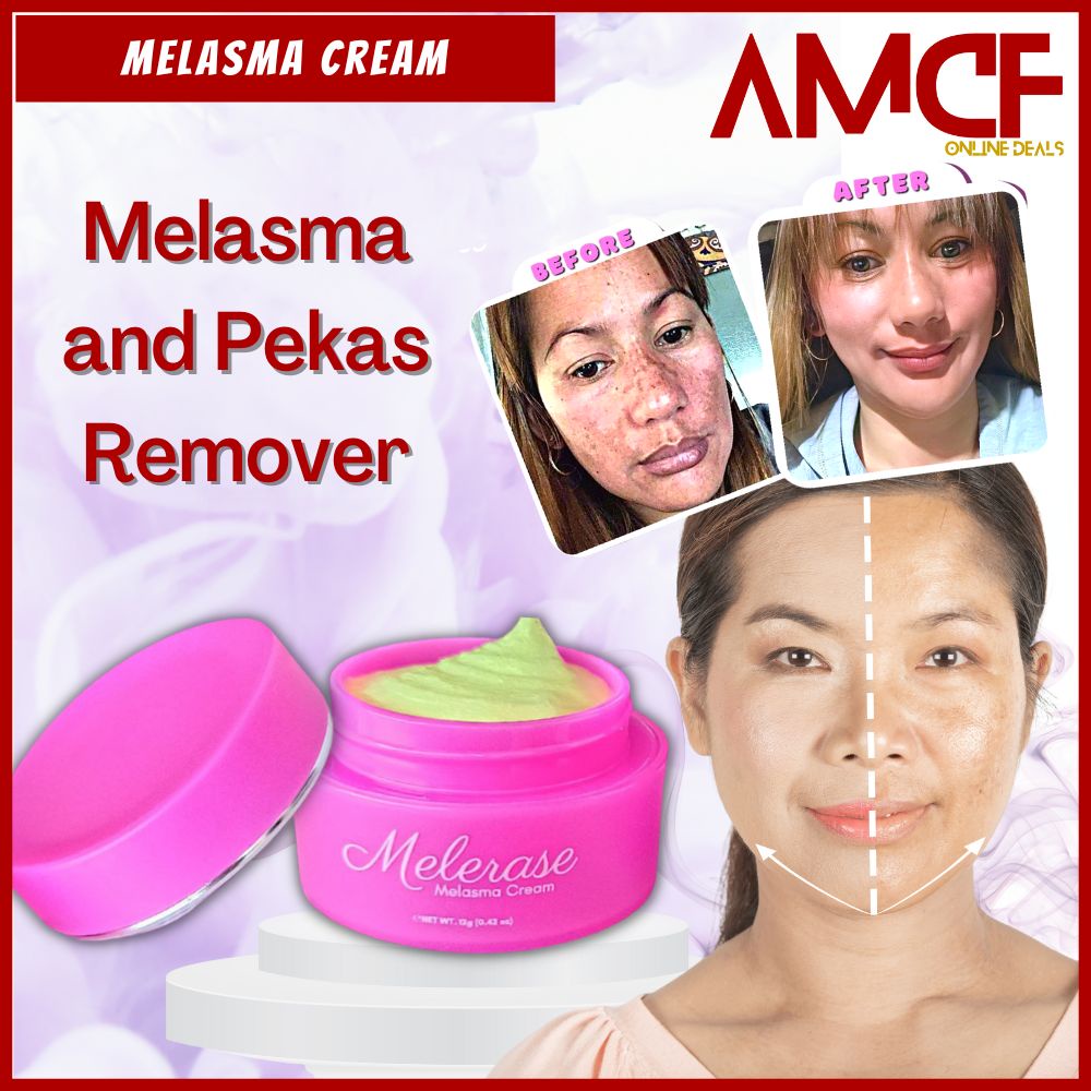 TOP SELLING Melerase Melasma Cream by Belle Glow 12g for Melasma treatment and Pekas Shopee