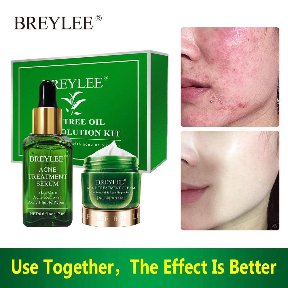 BREYLEE Acne Treatment Serum Cream Kit Spots Pimple Removal Essence