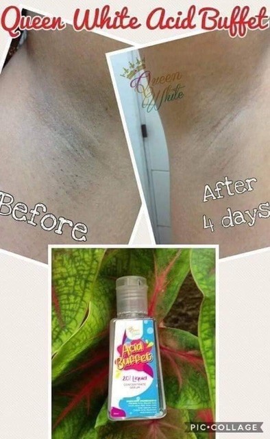 acid buffet serum