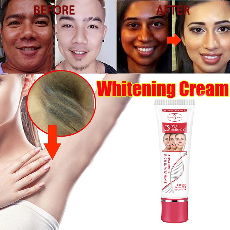 Acne Treatment Cream Pimple Marks Remover Pimple remover Face Cream