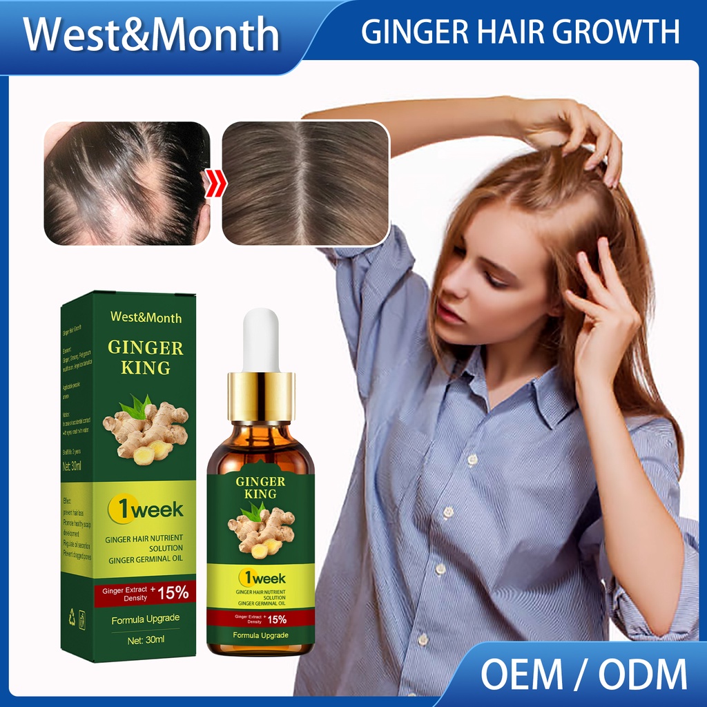 Hair Growth Essence Oil Ginger Hair Grower Serum Spray Anti Hair Loss  Treatment for men and women | Shopee Philippines
