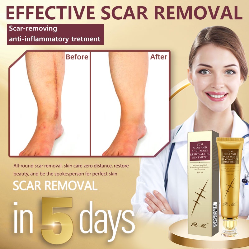 scar remover cream effective for legs old scar original peklat remover
