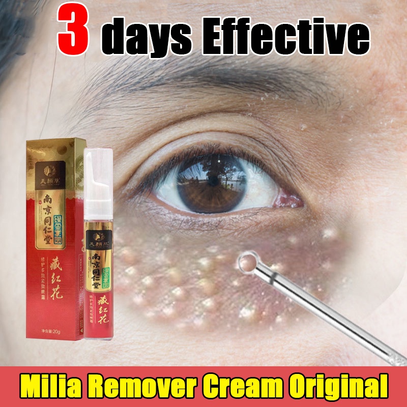 Milia Remover Cream Original 20ml eye bag remover original , circle in