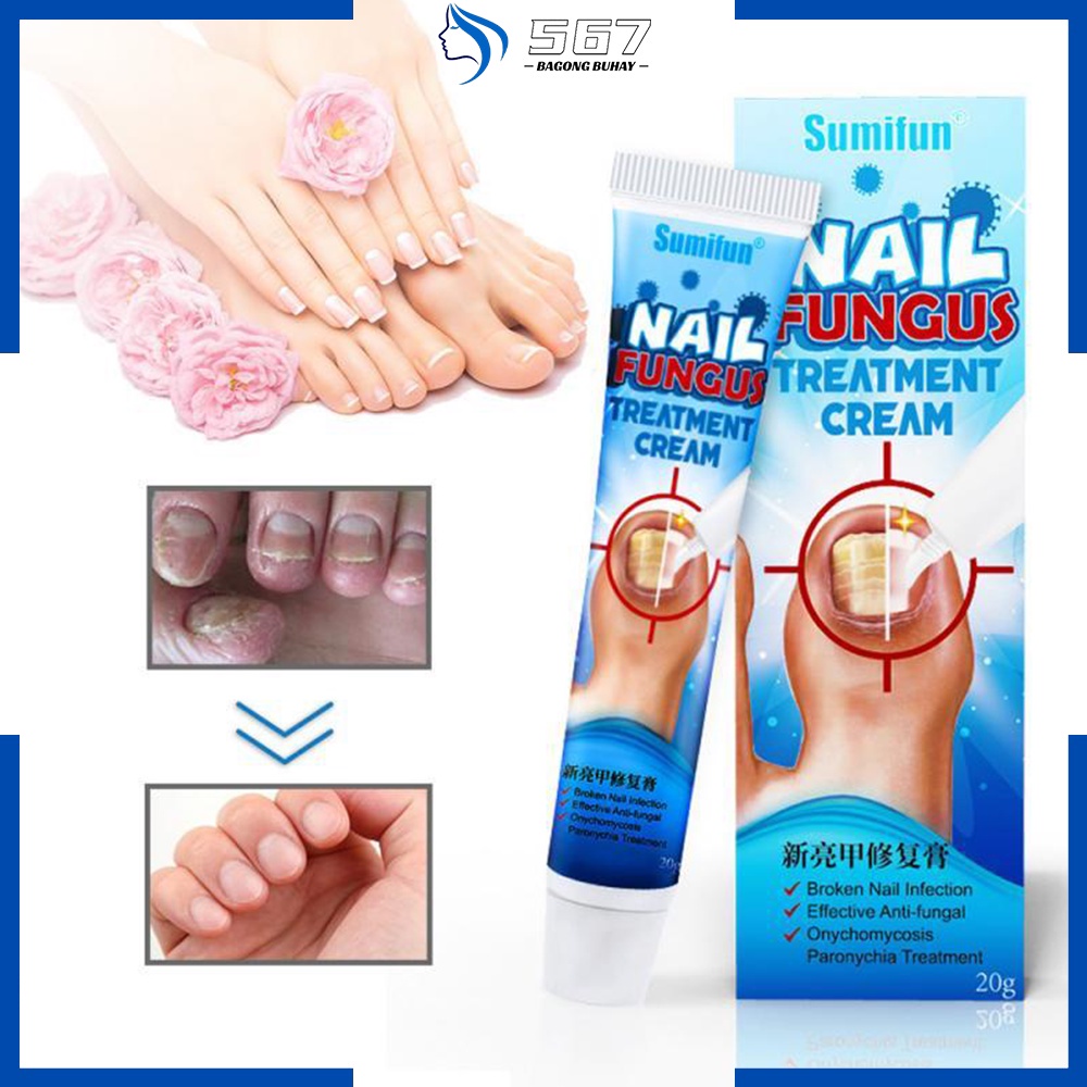 Nail Fungus Cream Antibacterial Cream Anti Fungal Cream Paronychia Nail Care Repair Ointment 20G