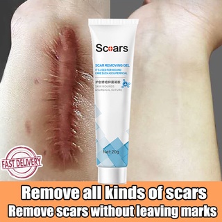 Scar Removal Cream Peklat Remover Acne Treatment Scar remover cream stretch mark Cream