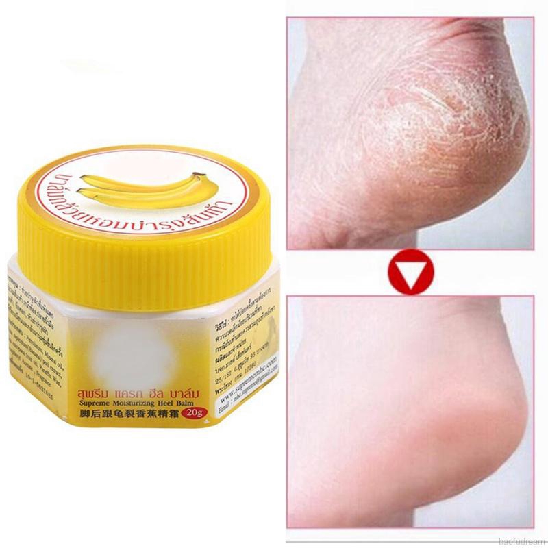 dead skin remover cream