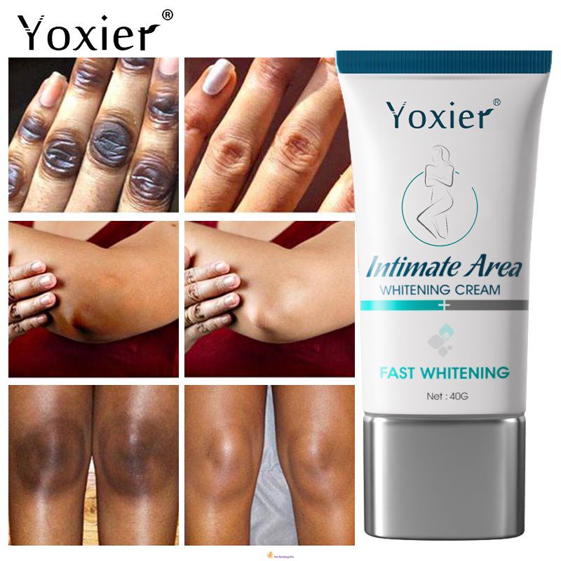 Yoxier Whitening Dark Spot Cream Even Skin Tone Brighten And Moisturize Elbows Legs Knees Neck